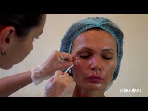 Видео: Инъекции ботокс #6