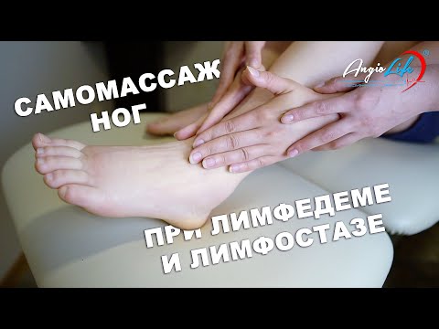 Видео: Самомассаж ног при лимфостазе и лимфедеме. Лечение лимфостаза дома. Лечение отеков. Массаж лимфедема