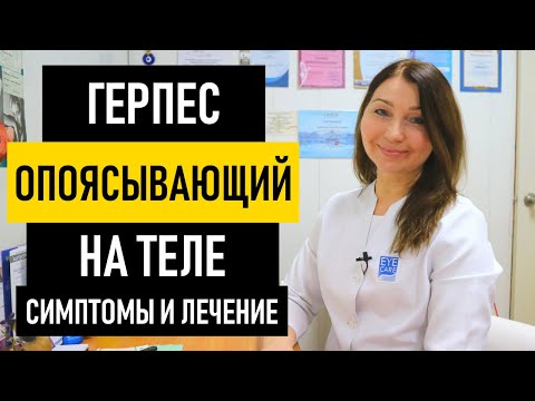 Видео: Опоясывающий герпес: симптомы и лечение. Чем и как лечить опоясывающий лишай на теле