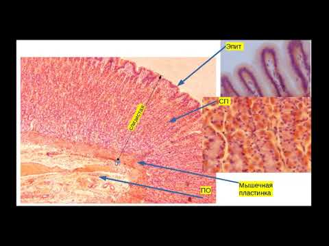 Видео: Гистологическое строение стенки дна желудка. Препарат: Дно желудка. Строение фундальной железы жел.