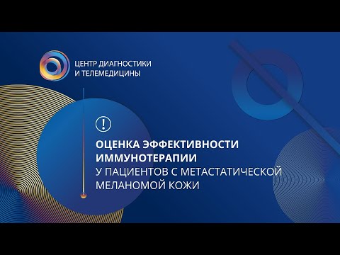 Видео: Оценка эффективности иммунотерапии у пациентов с метастатической меланомой кожи: КЛИНИЧЕСКИЕ СЛУЧАИ