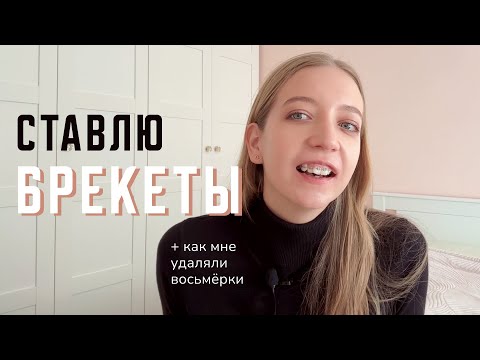 Видео: VLOG Ставлю брекеты | История моих зубов, удаление восьмёрок