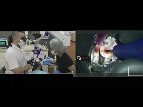 Видео: Запись с живого мастер-класса на пациенте. Красноярск 2018