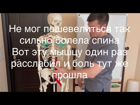 Видео: Так сильно болела спина что не мог ходить. Расслабил эту мышцу и боль сразу прошла