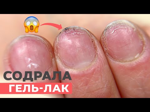 Видео: СОРВАЛА ногти с гель-лаком | Что будет если содрать гель-лак?
