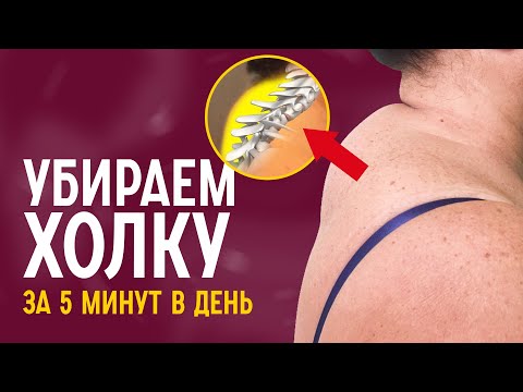 Видео: Как избавиться от холки | У вас есть вдовий горб? Проверьте!
