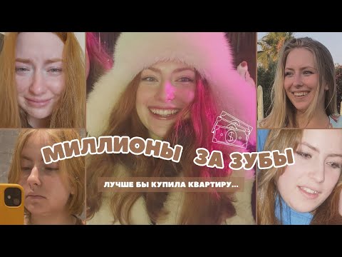 Видео: Моя история зубов: О чем вам не расскажут стоматологи - элайнеры, брекеты, коронки