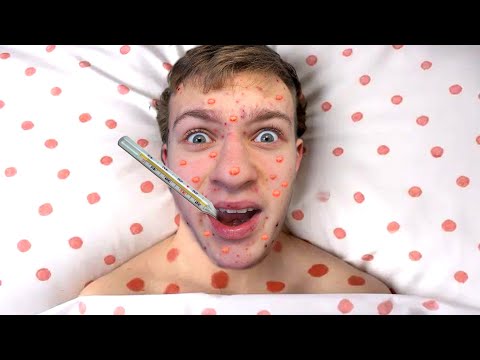 Видео: У Тимы ВЕТРЯНКА 🤒 Кто ВИНОВАТ?