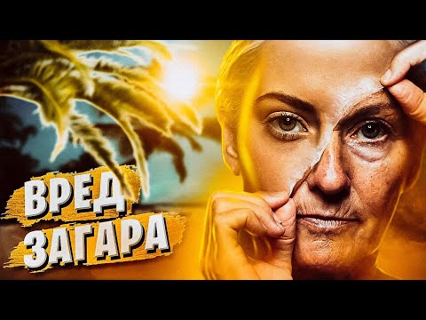 Видео: ЗАГАР и СОЛНЦЕ: риски, последствия, рак, фотостарение, эластоз