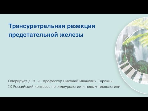 Видео: ТУР предстательной железы