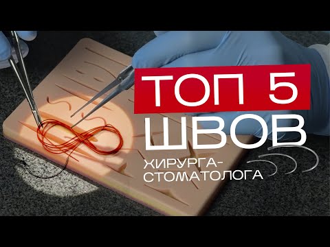 Видео: ТОП 5 ШВОВ ХИРУРГА-СТОМАТОЛОГА