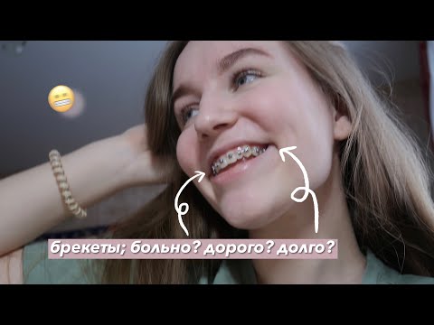Видео: я поставила брекеты! первые дни и ощущения🦷