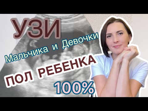 Видео: Узи мальчика и узи девочки, на 1,2 и 3 скрининге. На каком сроке лучше смотреть пол ребенка.