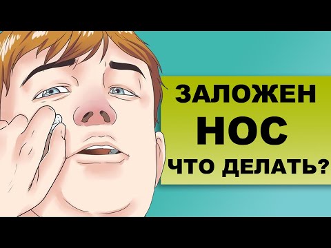 Видео: ЗАЛОЖЕН НОС. Причины. Как облегчить заложенность носа
