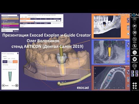 Видео: Презентация Exocad Exoplan и Guide Creator от Олега Воловикова на стенде ARTICON (Дентал Салон 2019)