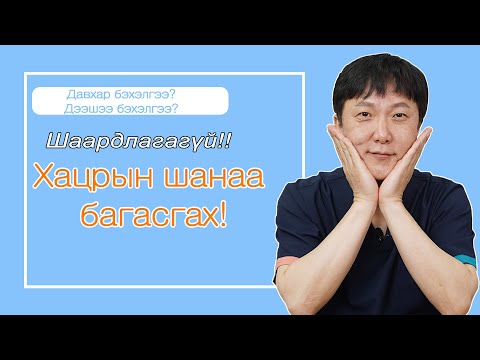 Видео: [Зөвхөн Лавианы онцгой хацрын шанаа багасгах мэс засал! ] Хацрын нум / Солонгос гоо сайхны эмнэлэг