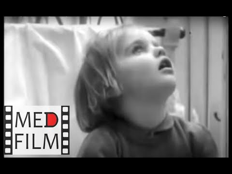 Видео: Как определить аутизм у детей ©