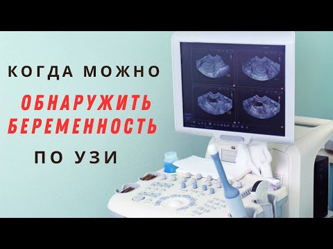 Видео: Когда по УЗИ можно обнаружить беременность @Dr. Olena Berezovska #doctorberezovska #беременность #УЗИ