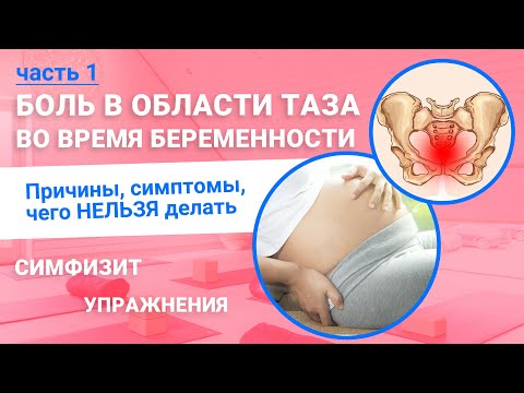 Видео: Симфизит. Боль в области таза при беременности. Причины и запрещенные упражнения (часть 1)