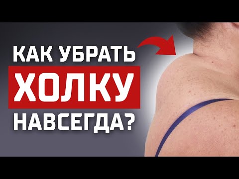 Видео: Любая холка уйдёт НАВСЕГДА! Два шикарных упражнения уберут ВДОВИЙ ГОРБ!