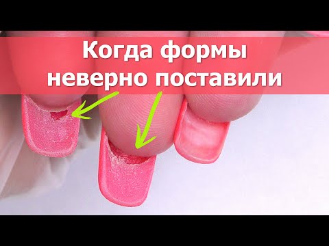 Видео: Отслойки ГЕЛЯ на Ногтях , Сломанные Боковые - Как сделать коррекцию!?