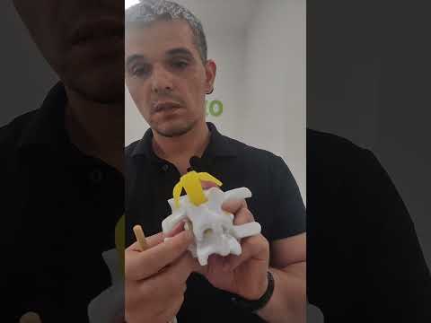Видео: Видове болка в гръбначния стълб