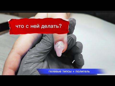 Видео: Нет ничего лучше сложного случая! #жуковский #маникюр #ногти #грызун #ковыряшка #наращиваниеногтей 