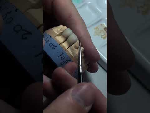 Видео: Глазурирование керамики 🦷😉