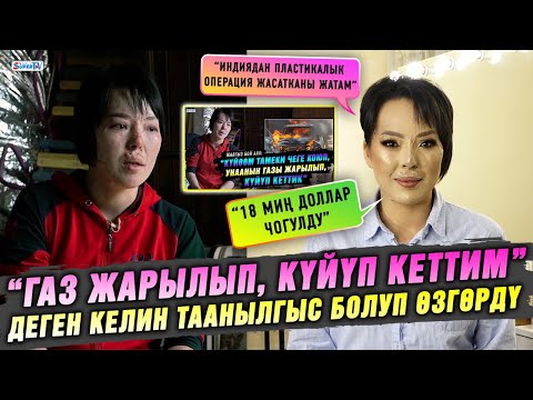 Видео: “Газ жарылып, күйүп кеттим” деген келин таанылгыс болуп өзгөрдү