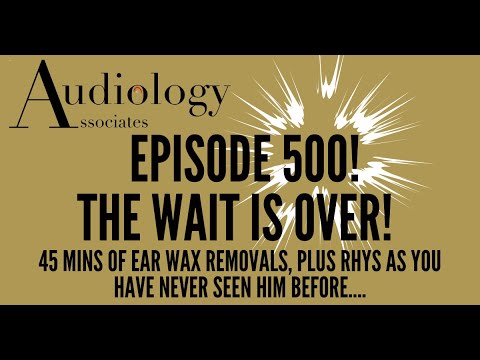 Видео: 45 МИНУТ УДАЛЕНИЯ УШНОЙ СЕРЫ (С ИЗЮМИНКОЙ) - EP500