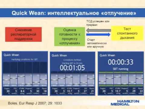 Видео: Развитие технологий интелектуальной ИВЛ (кИВЛ14дек) Сатишур О. Е.