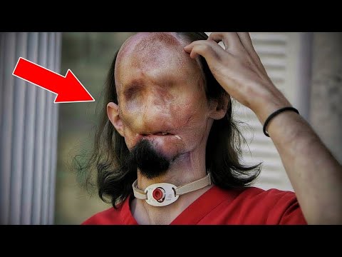 Видео: 10 уникальных людей с отсутствующими частями тела.