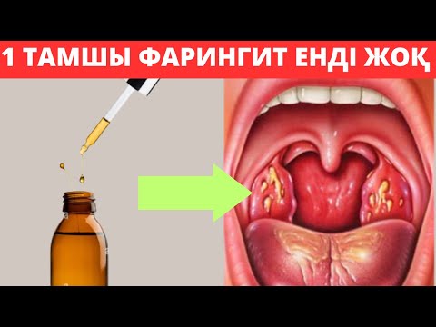 Видео: Фарингит емі қазақша. Қалай мен Фарингитті тез жоқ қылдым?