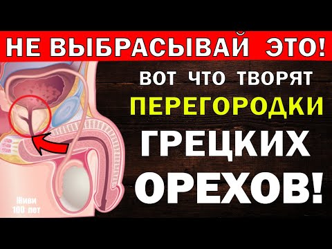 Видео: Что лечат перегородки грецких орехов / Ореховая настойка / Йод