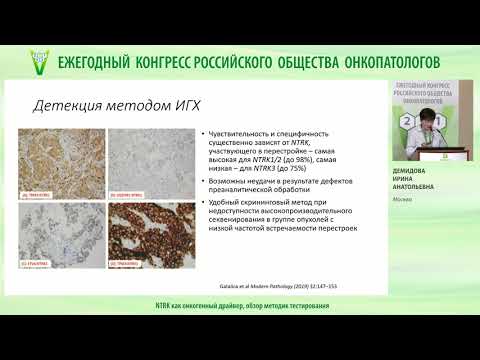 Видео: NTRK как онкогенный драйвер, обзор методик тестирования