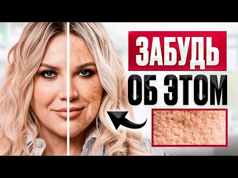 Видео: Как избавиться от ПОСТАКНЕ? Пошаговый рецепт от пятен и рубцов