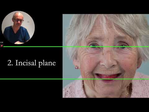 Видео: Изготовление полного верхнего воскового валика по естественному зубному ряду нижней челюсти. Финл...