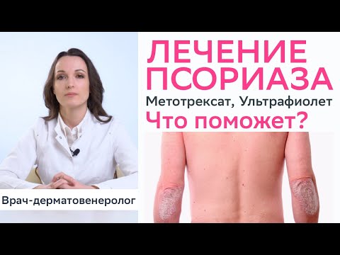 Видео: Лечение псориаза - метотрексат, кальципотриол, ультрафиолет, PUVA, грязевые ванны, солнечный загар