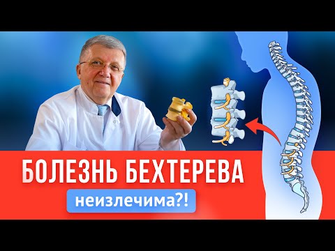 Видео: Болезнь Бехтерева НЕ ПРИГОВОР? Симптомы, лечение, профилактика, упражнения