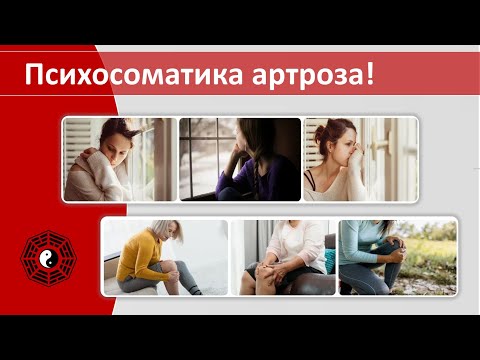 Видео: Психосоматика артроза