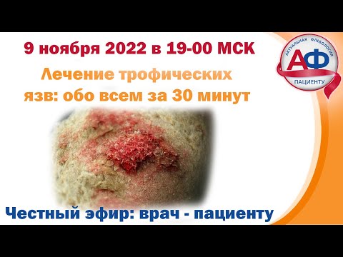 Видео: Лечение венозных трофических язв  Коротко за 30 мин для пациентов