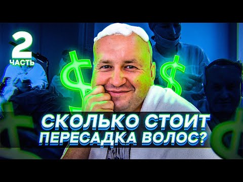 Видео: Сколько стоит пересадка волос в Махачкале | Часть 2 | Моя история трансплантации волос