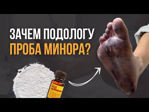 Видео: Зачем подологу проба Минора? #подолог #грибок #онихолизис #педикюр #ногти