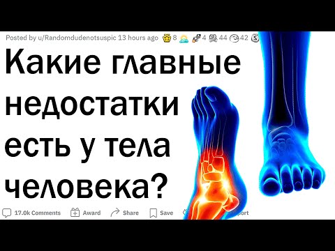 Видео: Какие минусы есть в наших телах?