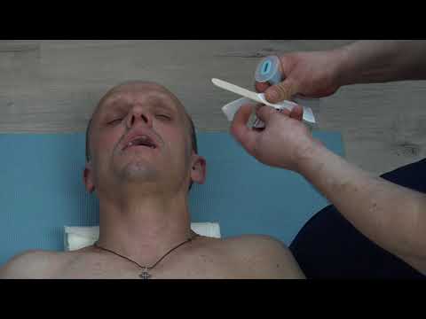 Видео: коникотомия наложение шва на подъязычную артерию внутривенная инфузия на приеме стоматолога