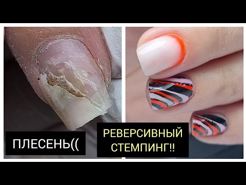 Видео: ПЛЕСЕНЬ  как быть?