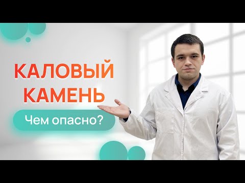 Видео: Что такое каловый камень и чем он опасен при запоре