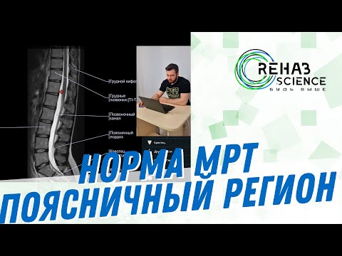 Видео: Норма МРТ. Поясничный регион