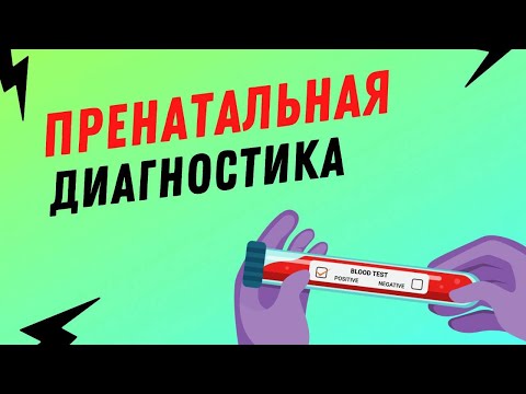 Видео: ПРЕНАТАЛЬНАЯ ДИАГНОСТИКА #olenaberezovska #беременность