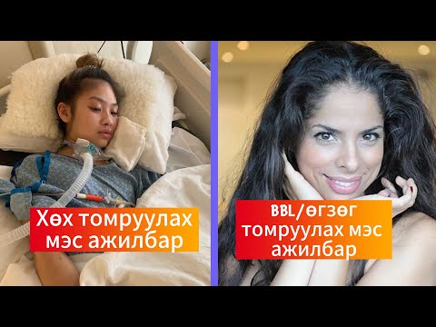 Видео: Podcast #130 Бүтэлгүйтсэн гоо сайхны хагалгааны 2 түүх